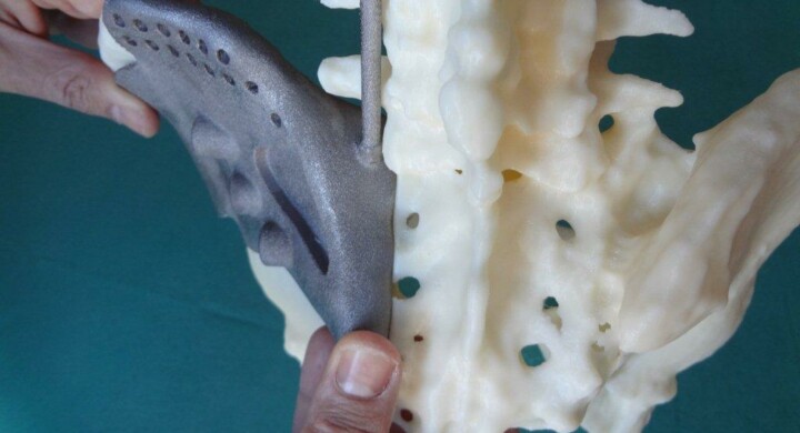 Come curare i tumori con le stampanti 3D